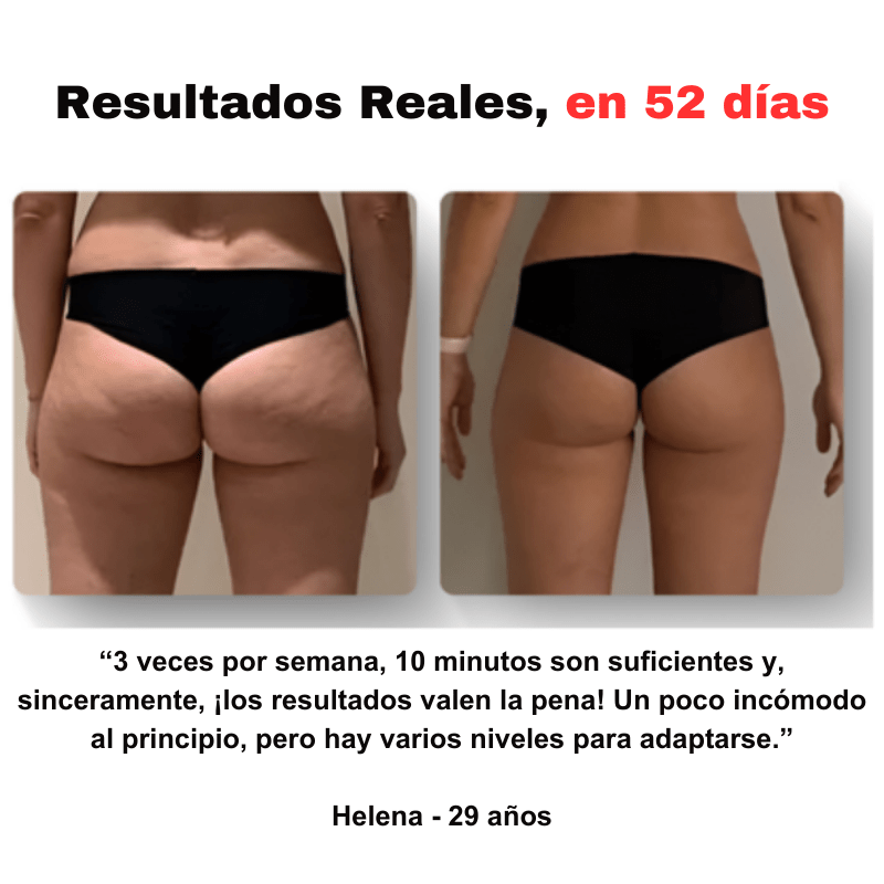 SmoothGlow™ - Masajeador anticelulítico